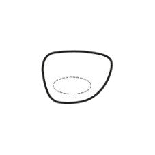 Bifocal